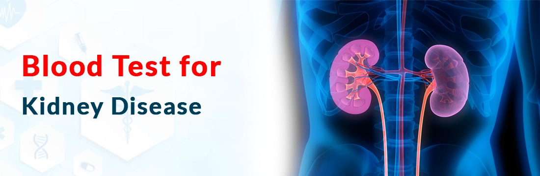 Blood Test for Kidney Disease